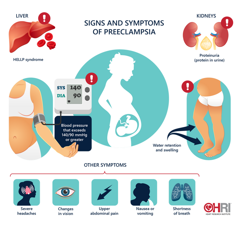 Preeclampsia Signs Symptoms And Treatment Heart Research Institute