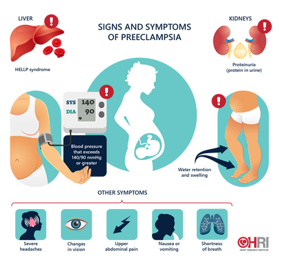 Preeclampsia: signs, symptoms and treatment • Heart Research Institute